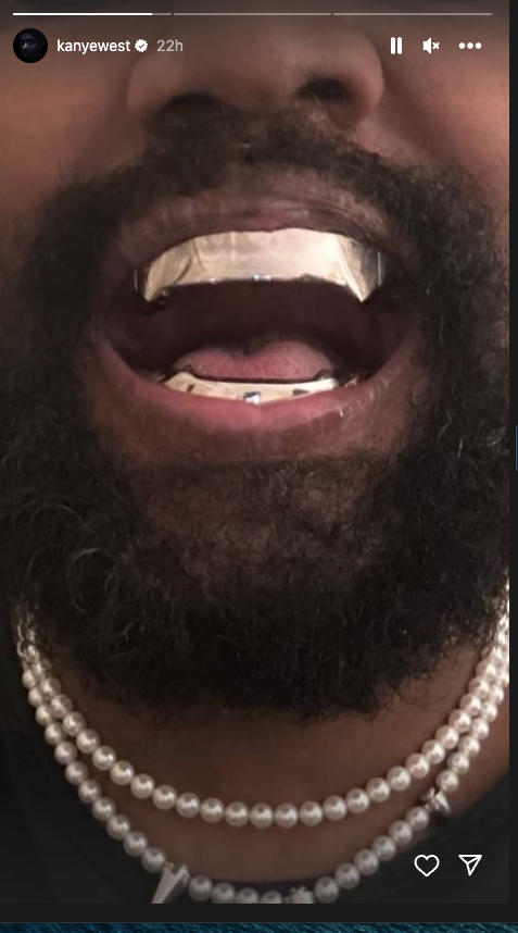 Kanye West titanium grill Instagram Stories